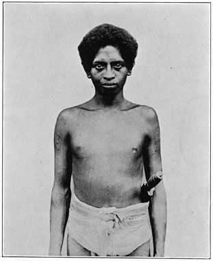 Negrito man from Aglao, Zambales.