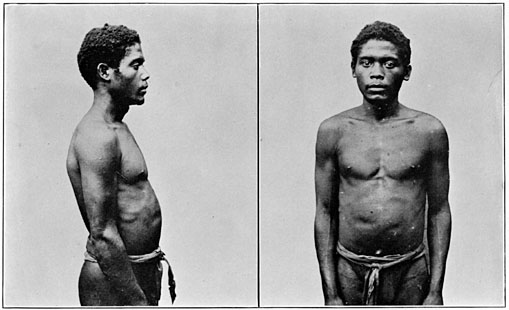 Negrito man of Zambales (pure blood).