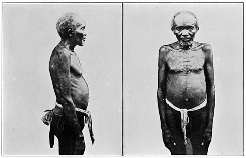 Old man of Zambales (pure Negrito), showing hair on face and chest.