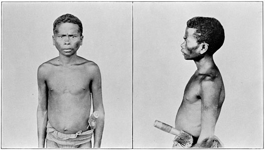 Negrito man of Zambales (mixed blood).