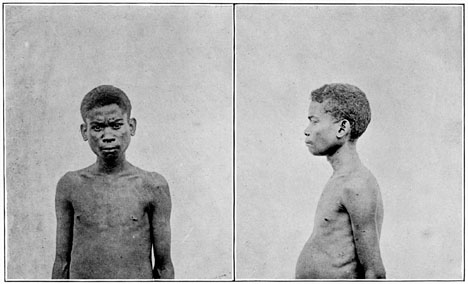 Negrito man of Negros (mixed blood).